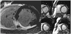 Cardiac Imaging